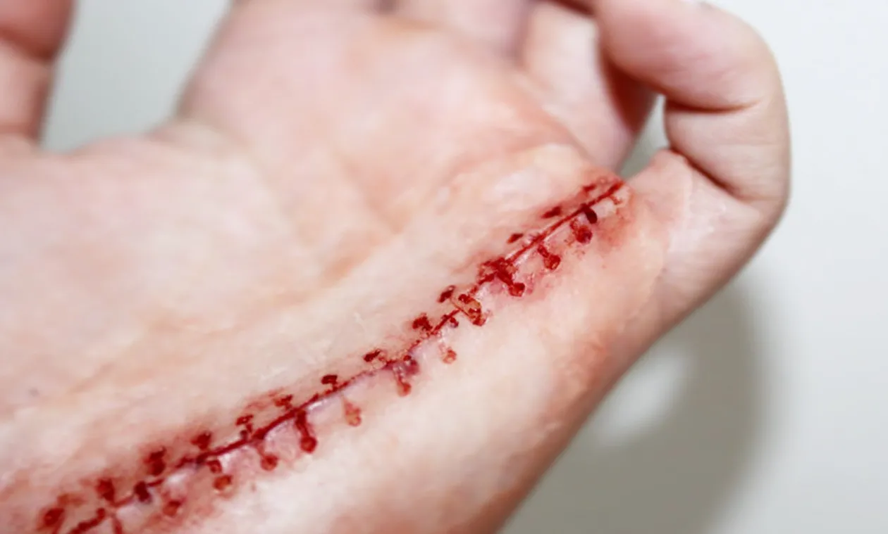 ForensicFX Studios Opened Stitches Prosthetic Store