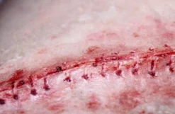 ForensicFX Studios Opened Stitches Prosthetic Store