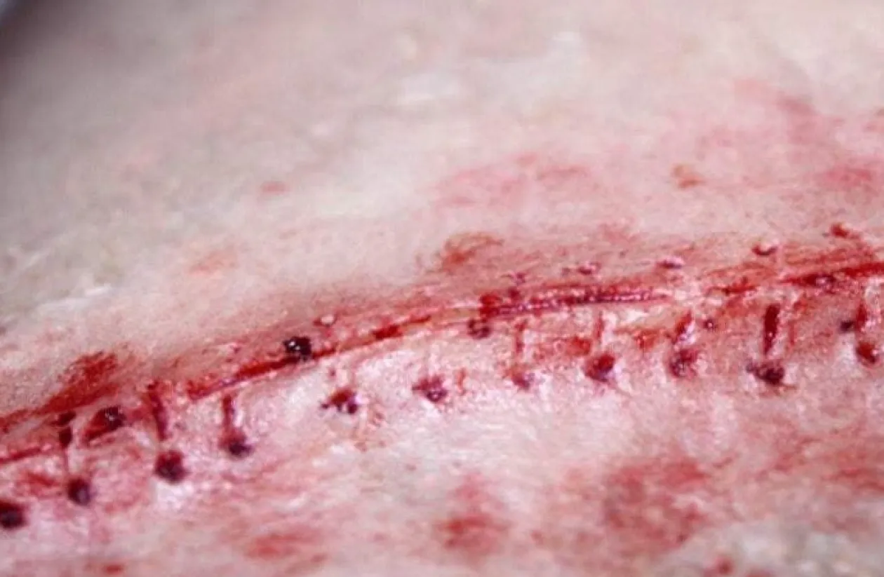 ForensicFX Studios Opened Stitches Prosthetic Store