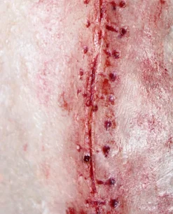 ForensicFX Studios Opened Stitches Prosthetic Store