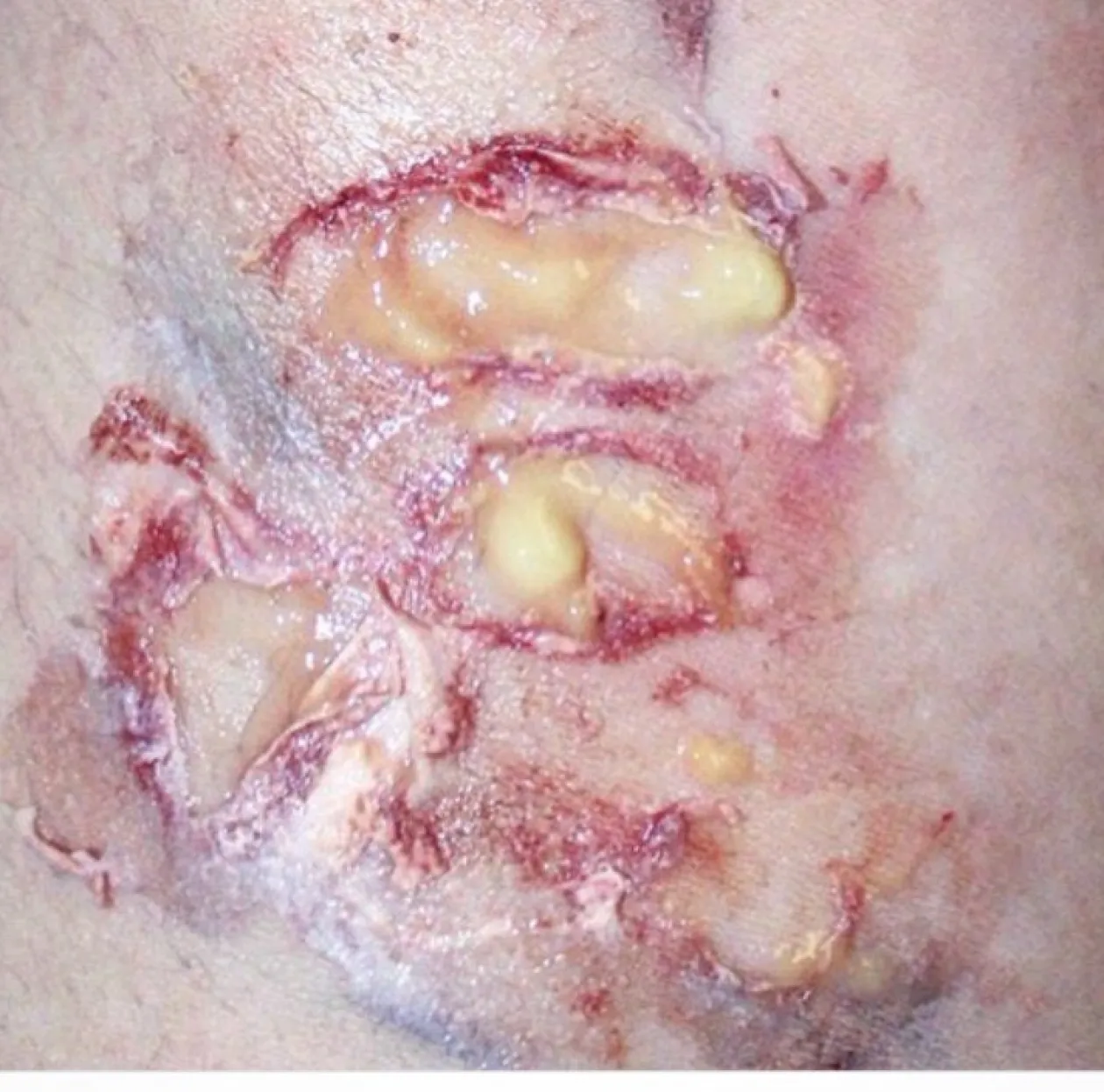 ForensicFX Studios Pus Makeup Effect Gel Sale