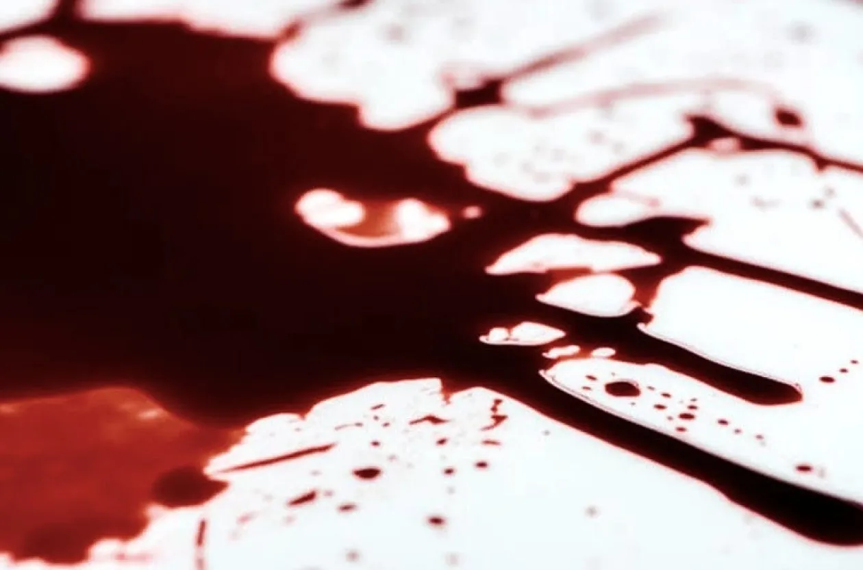 ForensicFX Studios Sfx Blood Bundle Clearance