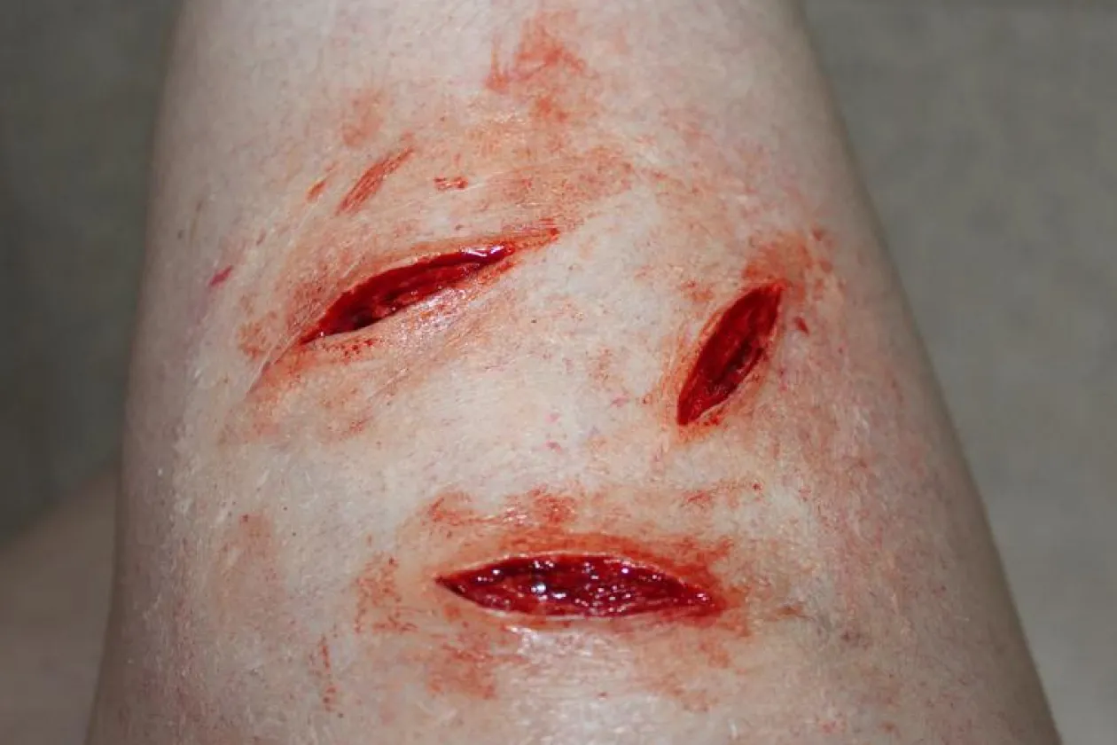 ForensicFX Studios Simple Prosthetics Bundle Shop