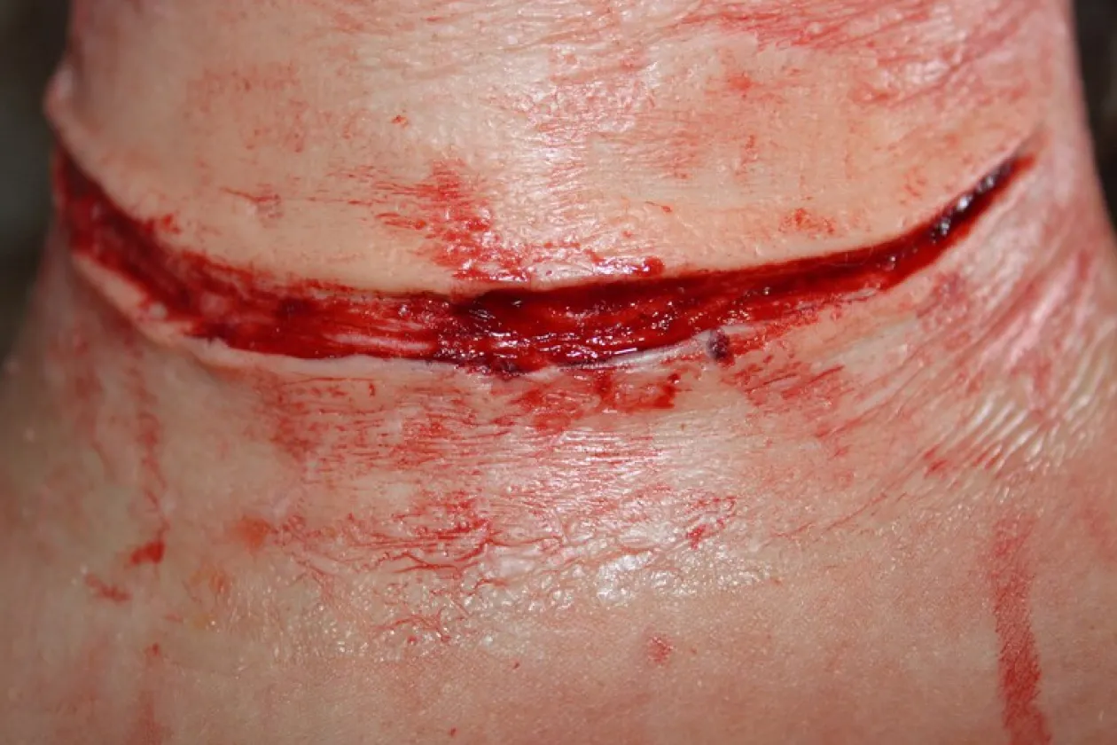 ForensicFX Studios Simple Slit Throat Prosthetic Best