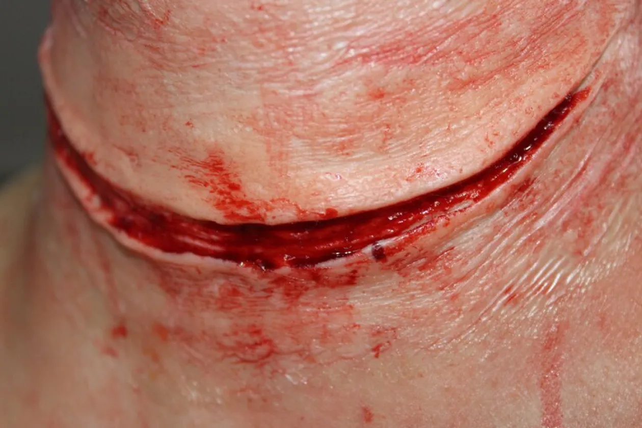 ForensicFX Studios Simple Slit Throat Prosthetic Best