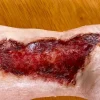 ForensicFX Studios Skin Burn Prosthetic Online