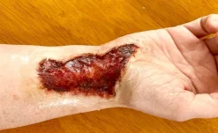 ForensicFX Studios Skin Burn Prosthetic Online