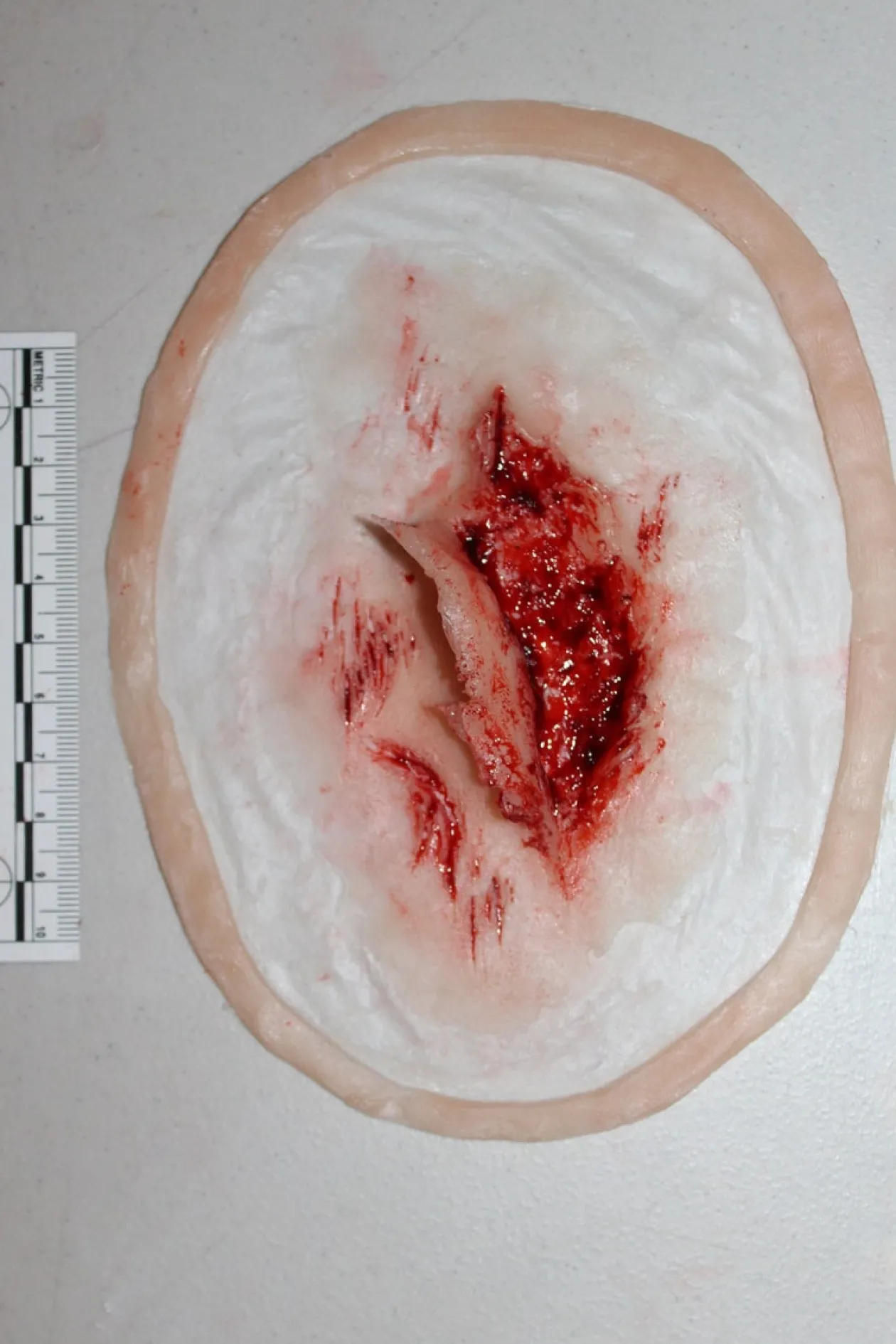 ForensicFX Studios Skin Peeling Back Wound Prosthetic Cheap
