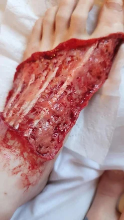 ForensicFX Studios Skinned Alive Prosthetic Bundle Discount