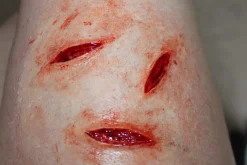 ForensicFX Studios Small Shallow Knife Stab Wounds (X3) Prosthetic Outlet