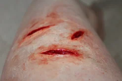 ForensicFX Studios Small Shallow Knife Stab Wounds (X3) Prosthetic Outlet