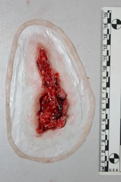 ForensicFX Studios Small Thigh Laceration Prosthetic Discount