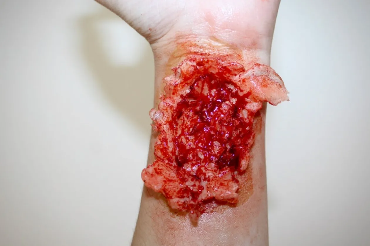 ForensicFX Studios Torn Wrist Prosthetic Flash Sale