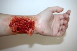 ForensicFX Studios Torn Wrist Prosthetic Flash Sale
