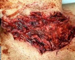 ForensicFX Studios Trauma Wounds Prosthetic Bundle Sale