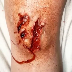 ForensicFX Studios Trauma Wounds Prosthetic Bundle Sale