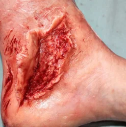 ForensicFX Studios Trauma Wounds Prosthetic Bundle Sale